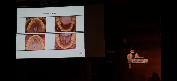 일산 이제서야 블로그를 시작하게 된 이유