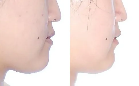 측모 관련 상태를 보여주는 사진
